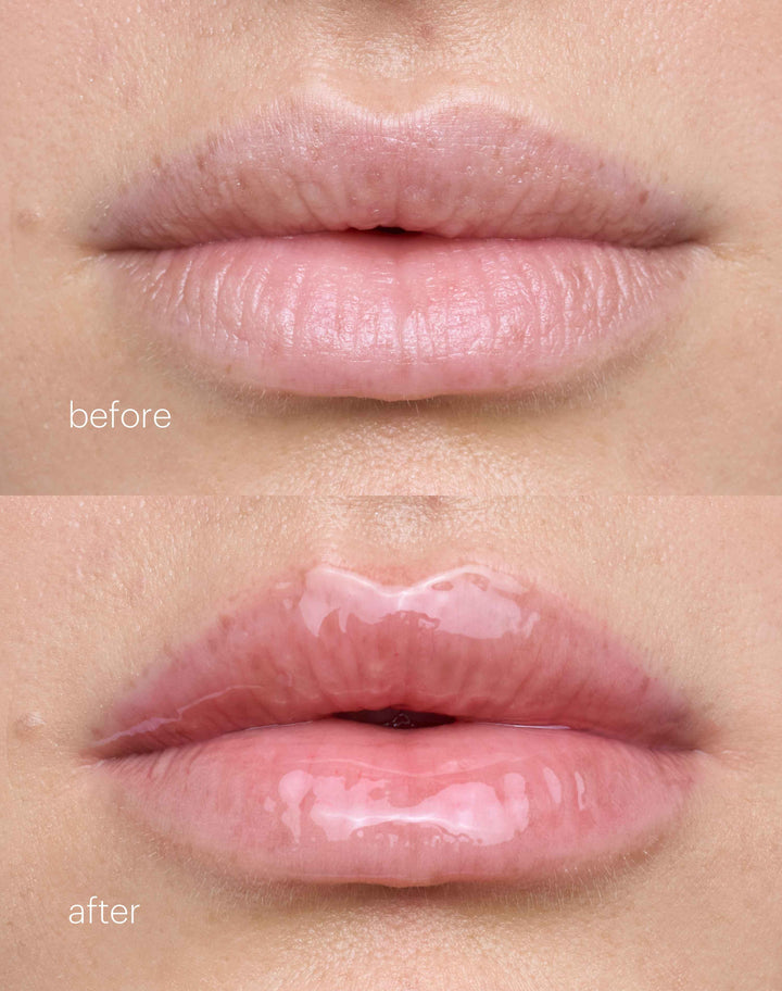 jelly-treat-lip-oil; slip: Before & After des Jelly Treat Lip Oils in Slip