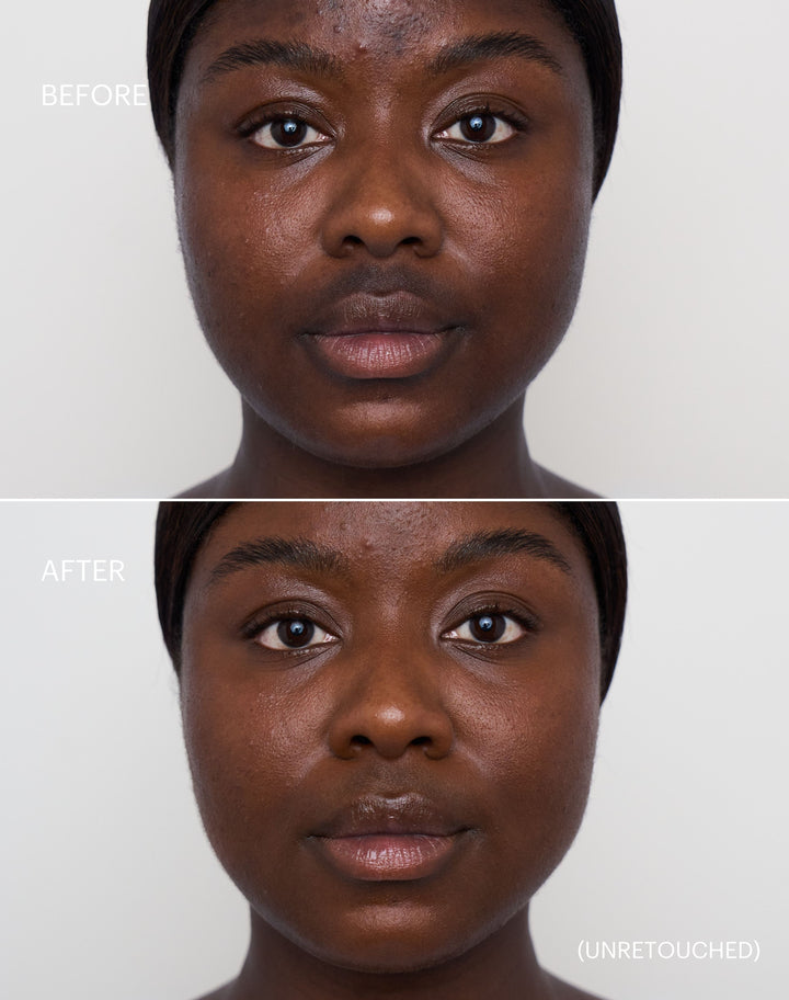 concealer-stick-spf-20; deep-1: Before & After der Shade Deep 1