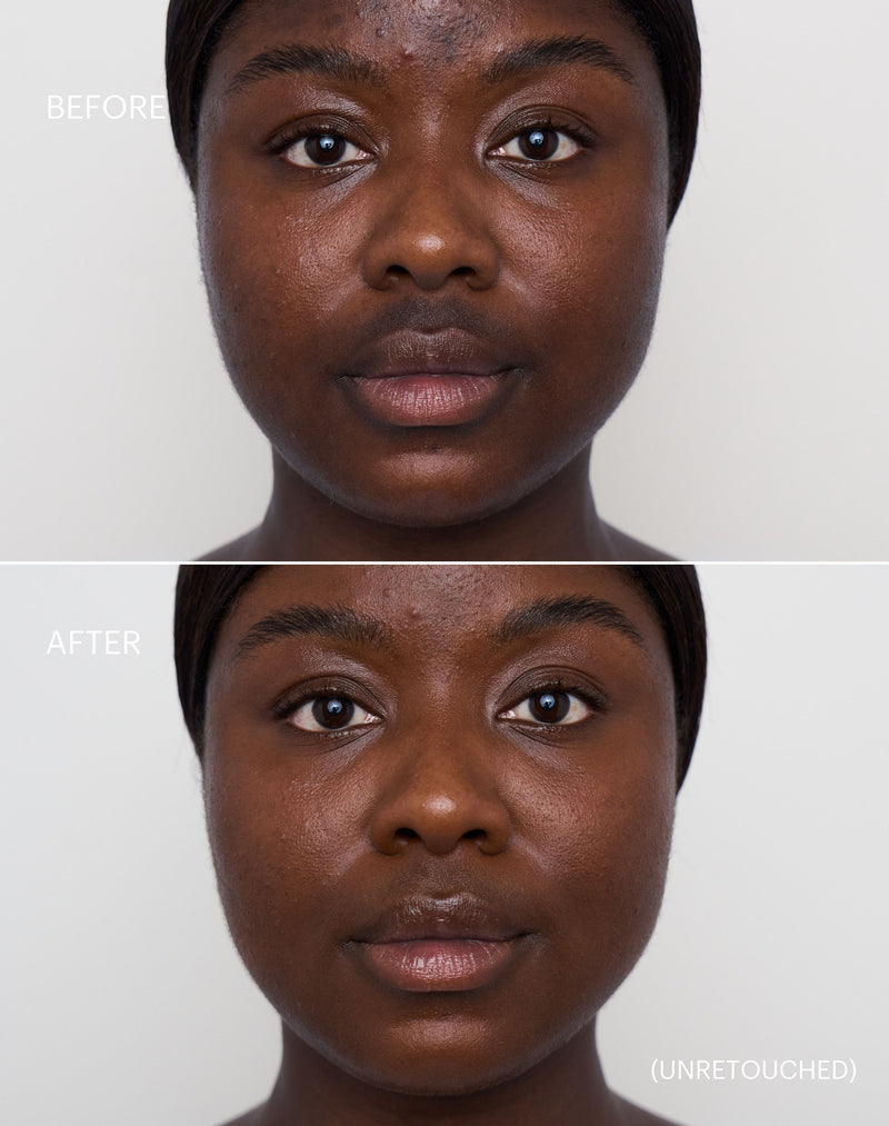 deep-1; Before & After der Shade Deep 1