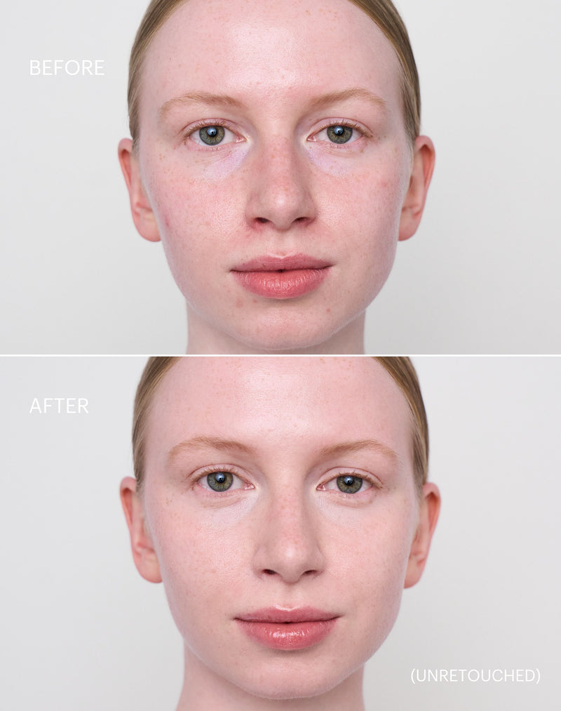 fair-2; Before & After der Shade Fair 2