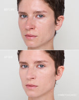 light-2; Before & After der Shade Light 2