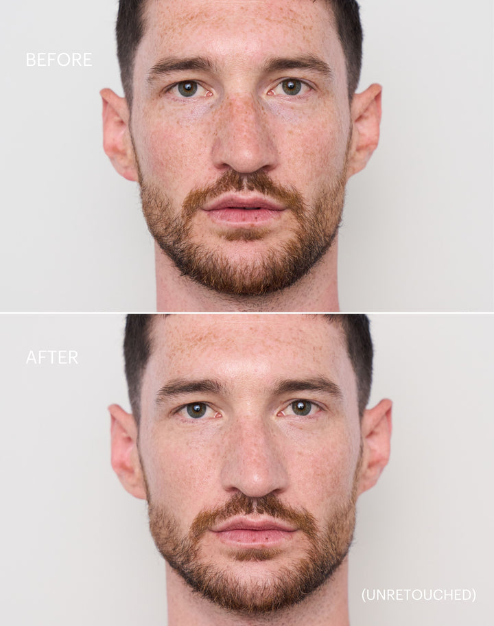 concealer-stick-spf-20; light-to-medium: Before & After der Shade Light to Medium