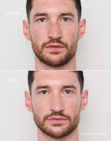 light-to-medium; Before & After der Shade Light to Medium