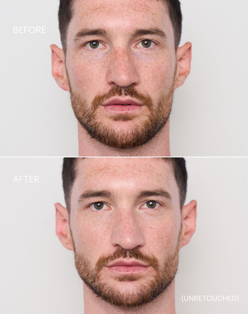 light-to-medium; Before & After der Shade Light to Medium