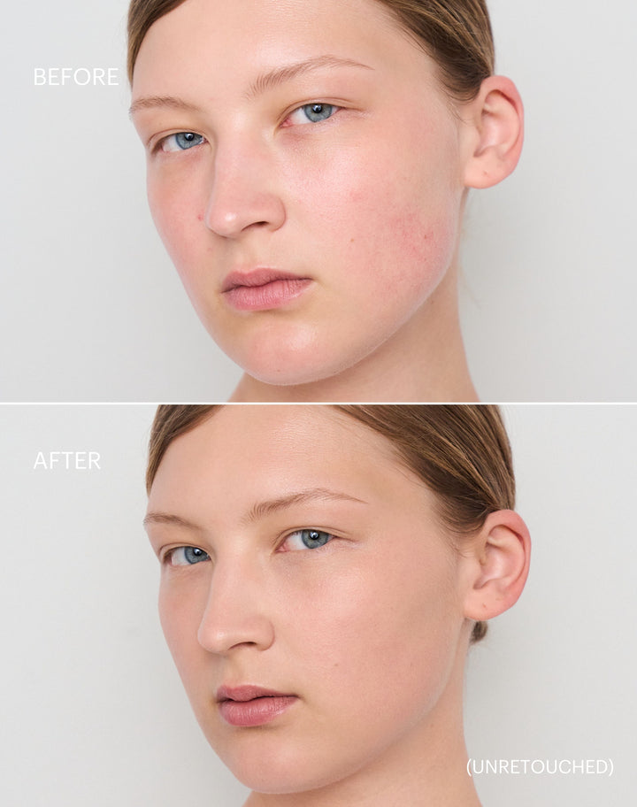 concealer-stick-spf-20; light-to-medium: Before & After der Shade Light to Medium