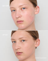 light-to-medium; Before & After der Shade Light to Medium