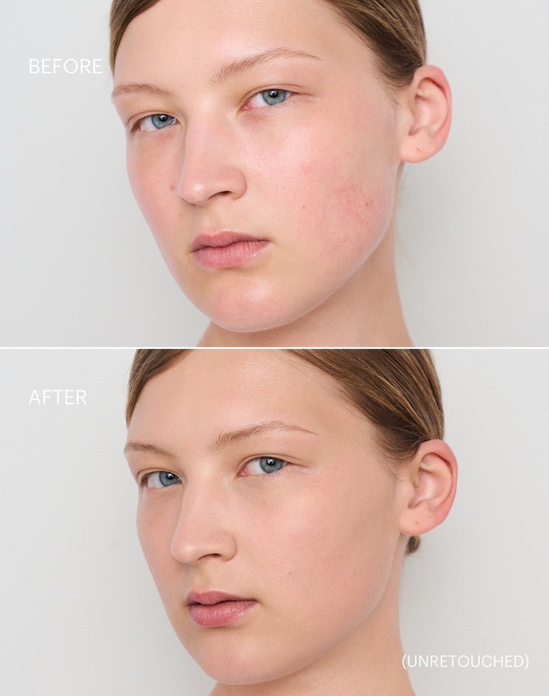 light-to-medium; Before & After der Shade Light to Medium