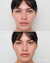 medium-1; Before & After der Shade Medium 1