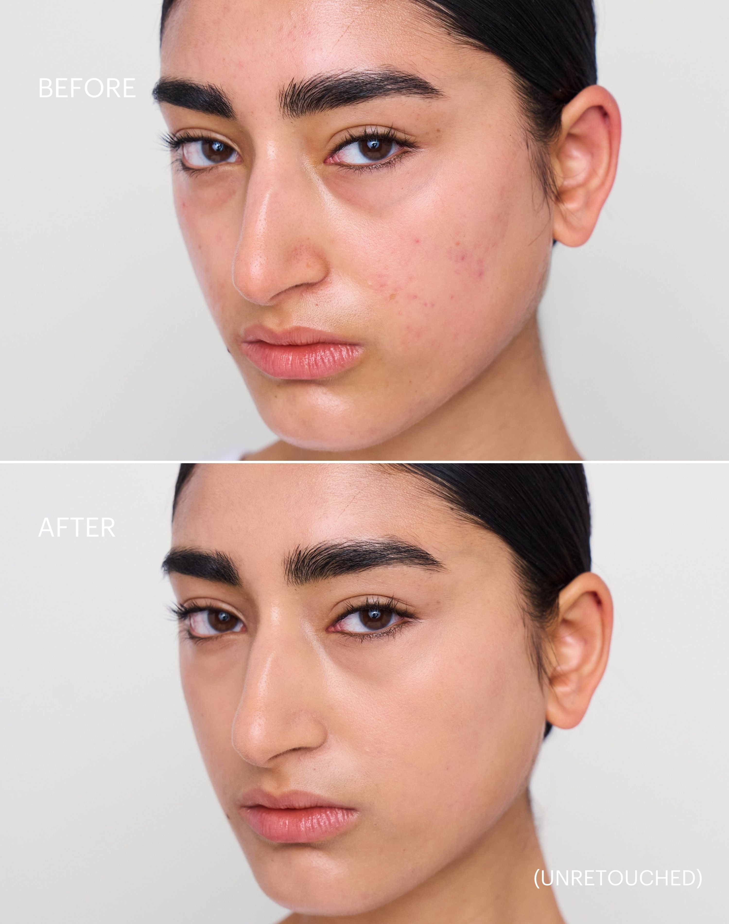 Concealer Stick SPF 20