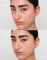 medium-2; Before & After der Shade Medium 2